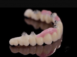 Do Mexican workplaces utilize current, super-advanced equipment for dental inserts?